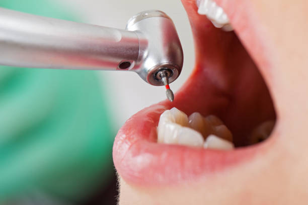Best Emergency Treatment for Toothache in West Chester, PA
